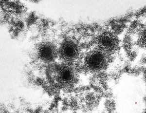 M,67y. | herpetic encephalitis (parafin embedded sample) M,67y. | herpetic encephalitis (parafin embedded sample)